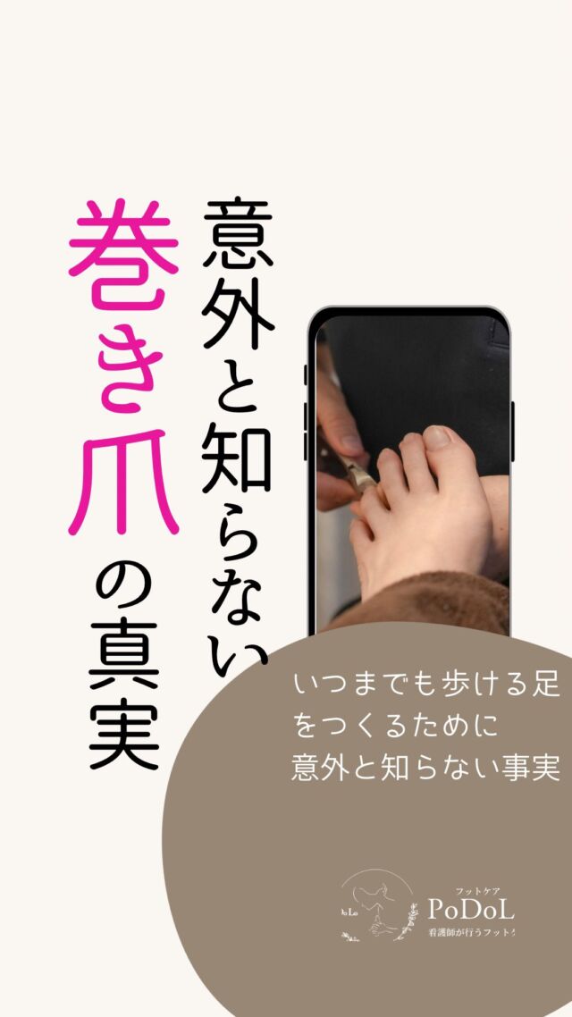 巻き爪さん、爪の「伸ばし過ぎ」にご注意です！
↪︎ @podolo_footcare.nuse 

実は、爪を伸ばし過ぎることも
巻き爪を悪化させる原因になるんです！
爪は性質上、伸ばし過ぎるとどんどん巻いてしまいます。

そこで大切なのが、
適切な爪の長さと足指を正しく使える足作り。

PoDoLoでは、
✔️ 爪ケアで正しい長さに整える
✔️ 足裏ケアで足指を使いやすくする
この2つのアプローチで巻き爪を根本から解消に導きます！

「巻き爪で悩んでいるけど、
どこに相談すればいいかわからない…」

そんな方は、ぜひ一度ご相談ください(^^)

プロフィールのリンクからご予約可能です！

#巻き爪ケア #フットケアサロン #足の悩み解消 #フットケアpodolo